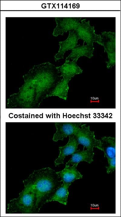 ATP6AP2 / Renin Receptor Antibody