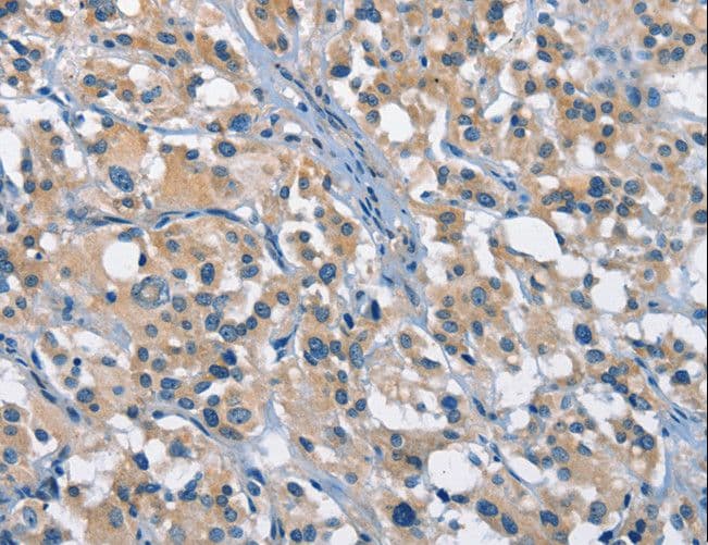 GAS2 Antibody