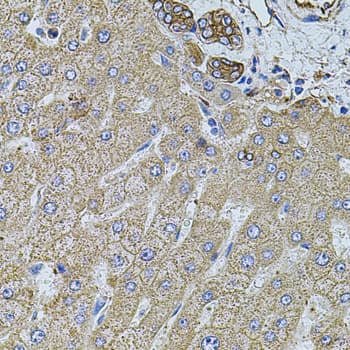 FLNB / TAP Antibody