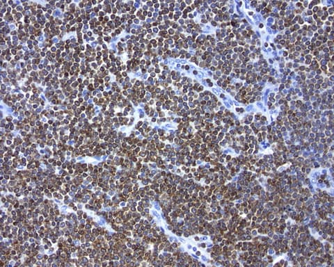 BCL2 / Bcl-2 Antibody (clone UMAB225)
