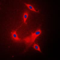 PPP2R1B Antibody (C-Terminus)