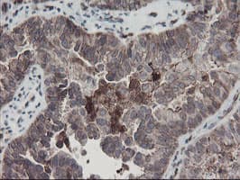 SENP2 Antibody (aa139-523, clone OTI3B12)