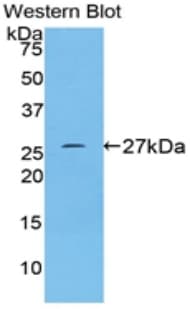 CD71 / Transferrin Receptor Antibody (aa567-744)
