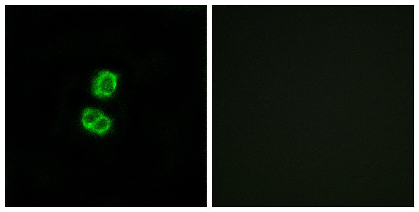 FGF22 Antibody