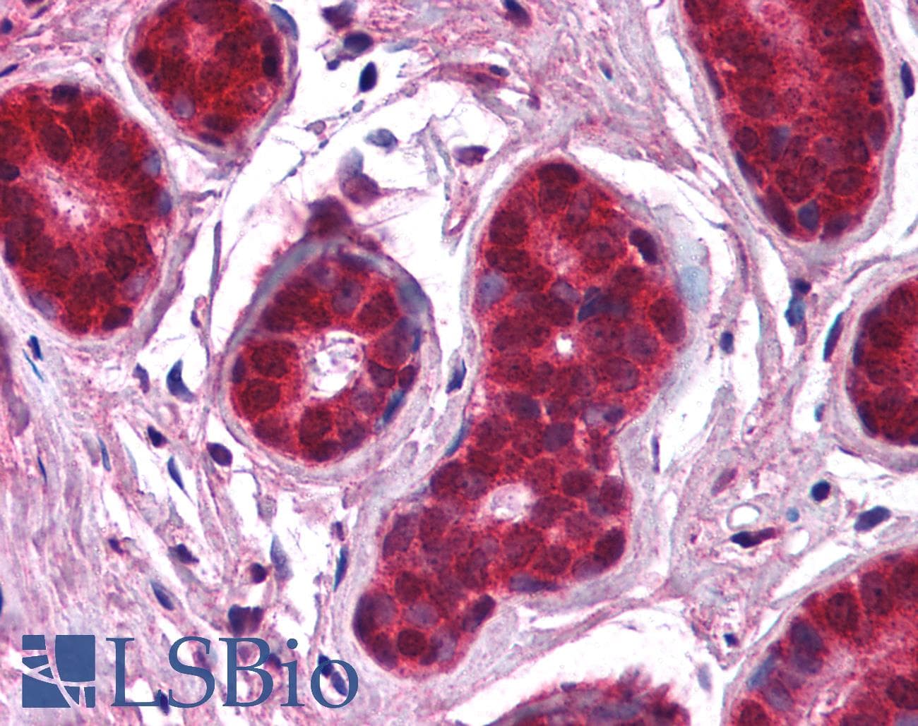 IHC-plus™ NFKBIA / IKB Alpha / IKBA Antibody (C-Terminus)