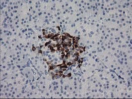 RGS5 Antibody (clone OTI1C1, Carrier-free)