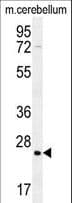 HRAS / H-Ras Antibody (aa146-176)