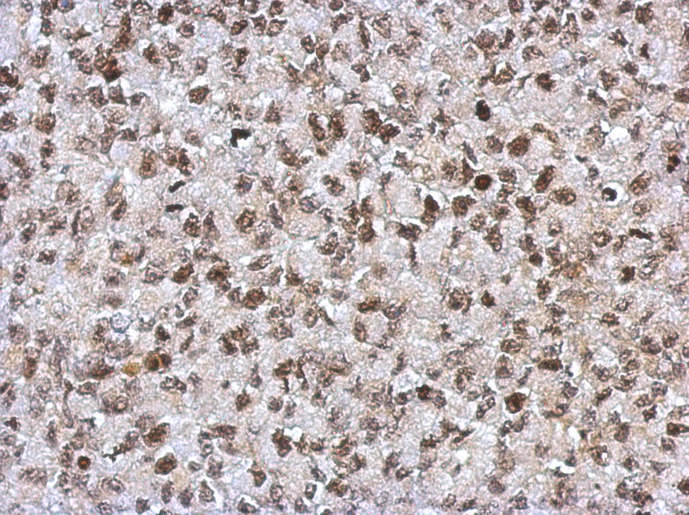 Polyclonal Rabbit anti-Human SAP130 Antibody (N-Terminus, IHC, WB)
