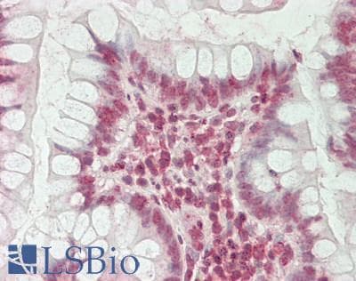 IHC-plus™ HERC2 Antibody (aa4784-4834)
