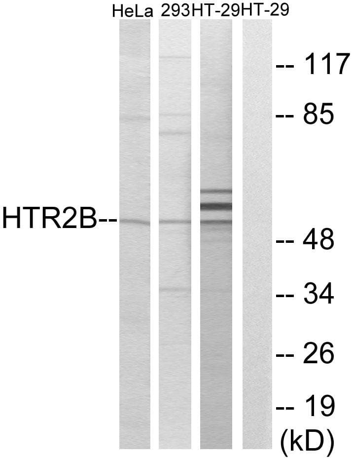HTR2B / 5-HT2B Receptor Antibody
