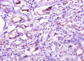Polyclonal Rabbit anti-Human NT5C1A / CN1A Antibody (IHC, WB)