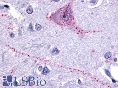 PathPlus™ TACR3 / NK3R Antibody (N-Terminus)