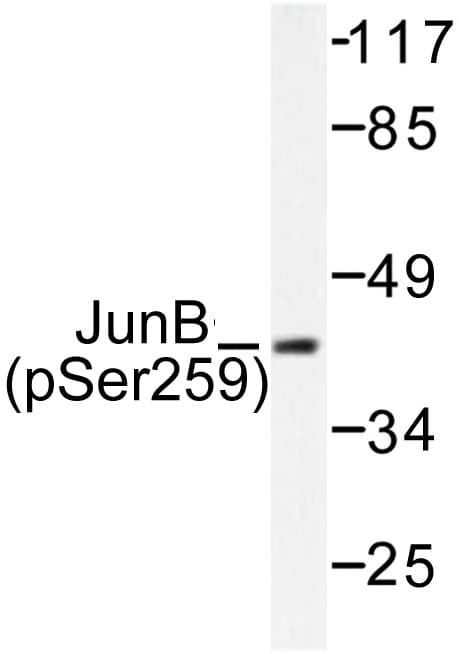 JUNB / JUN-B Antibody (phospho-Ser259)