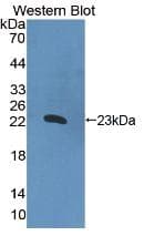 IL2 Antibody (aa1-142, FITC)