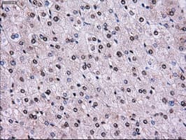 RPA2 / RFA2 / RPA34 Antibody (clone OTI8B3)
