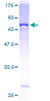 Human AP5Z1 Protein (Recombinant GST)