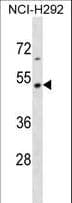 TEKT2 Antibody (aa103-132)