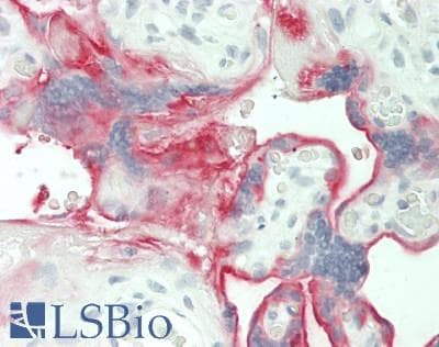 IHC-plus™ Monoclonal Mouse anti-Human NT5E / eNT / CD73 Antibody (clone 4G6B10, aa30-250, IHC, WB)
