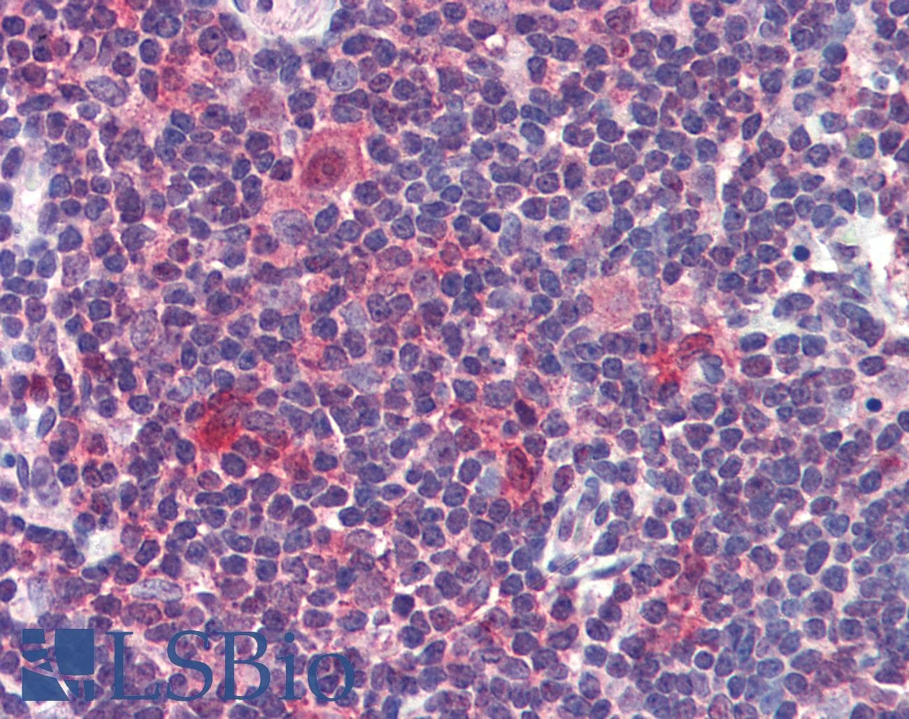 IHC-plus™ Polyclonal Rabbit anti-Human CASP7 / Caspase 7 Antibody (IHC, WB)