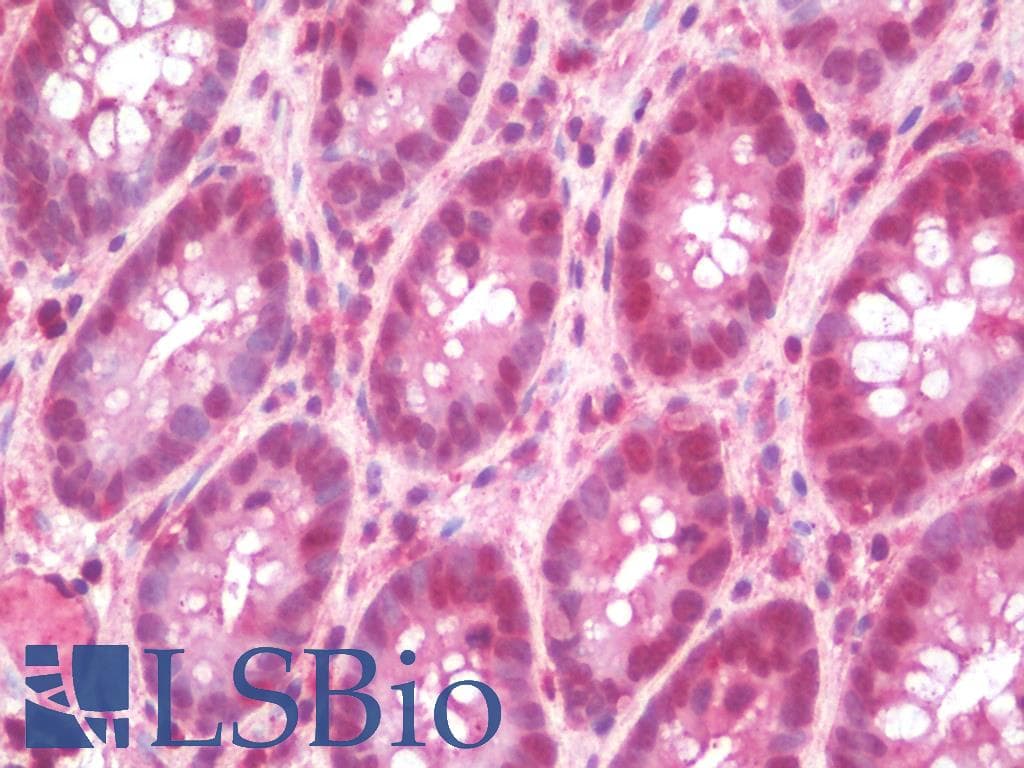 PathPlus™ BRAF / B-Raf Antibody