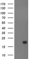 CST3 / Cystatin C Antibody (clone OTI1A6)