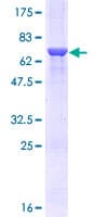 Human TRDMT1 / DNMT2 Protein (Recombinant GST)