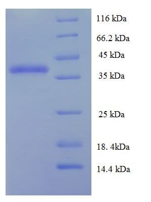 Human DGCR6L Protein (Recombinant His-SUMO)