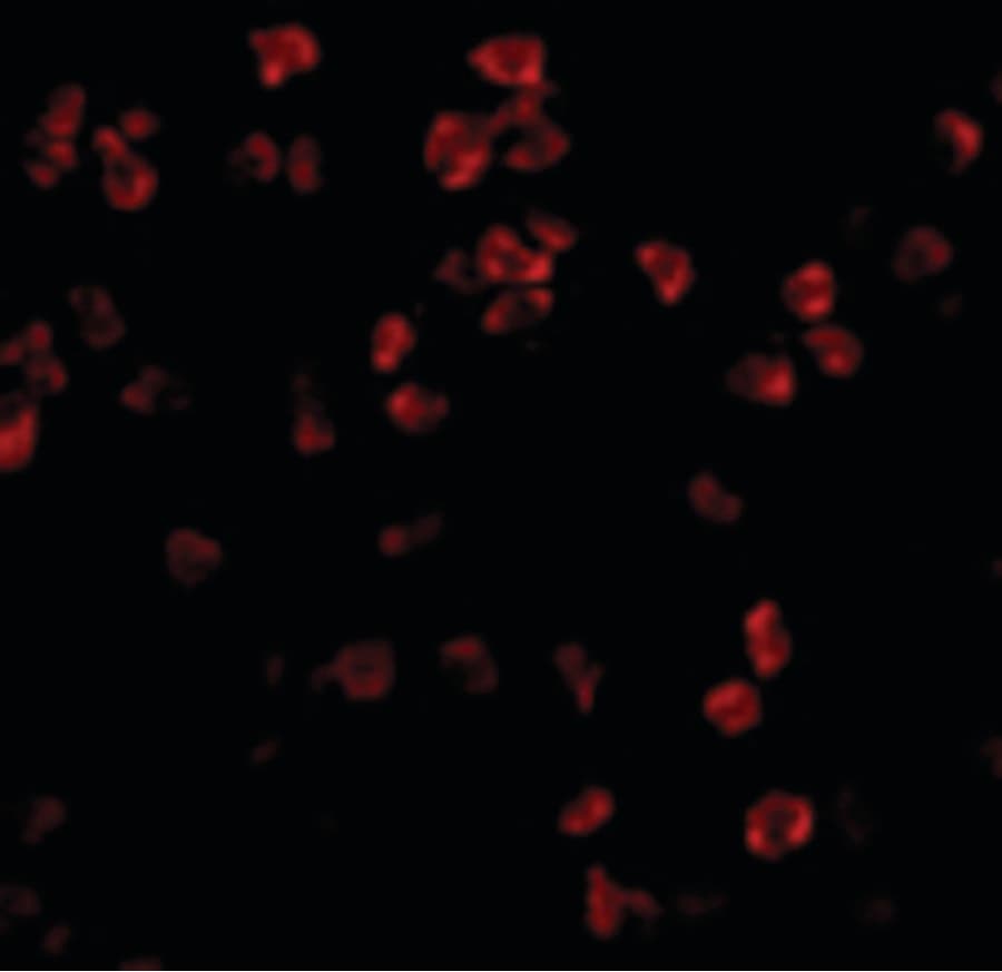 IHC-plus™ Polyclonal Rabbit anti-Human TLR5 Antibody (IHC, IF, WB)