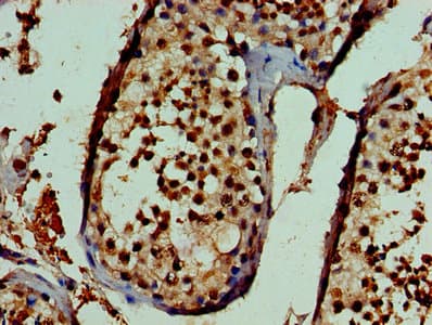 ASH2L / ASH2 Antibody (aa1-534)