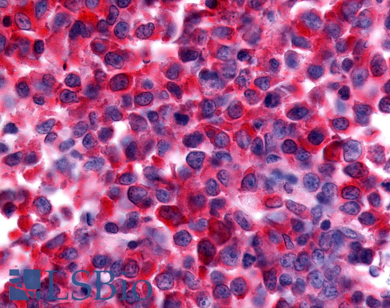 PathPlus™ NEK9 Antibody (Pro/Ser/Thr Rich Domain)