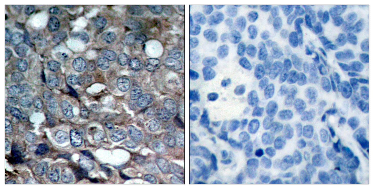MAP3K5 / ASK1 Antibody (phospho-Ser83)