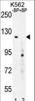 IHC-plus™ Polyclonal Rabbit anti-Human DEPDC5 Antibody (aa1404-1432, IHC, WB)