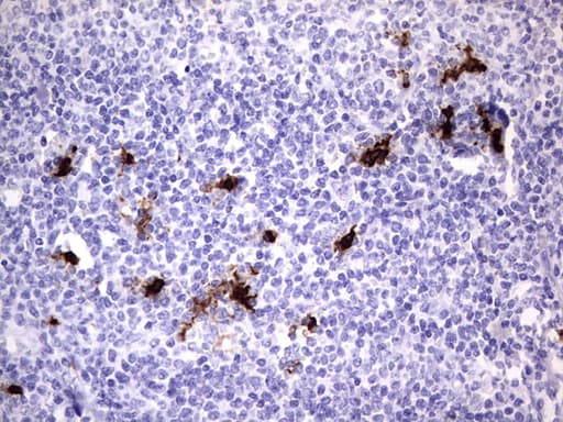 Monoclonal Mouse anti-Human S100A9 / MRP14 Antibody (clone OTI10D5, IHC, WB)