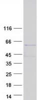 Human C17orf85 Protein (Recombinant Myc-DDK (Flag))