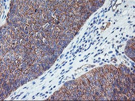 RTN4IP1 / NIMP Antibody (aa41-279, clone OTI1A8)