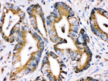 Polyclonal Rabbit anti-Human HSPA9 / Mortalin / GRP75 Antibody (IHC, WB)