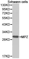 Polyclonal Rabbit anti-Human MPZ / P0 Antibody (IHC, WB)