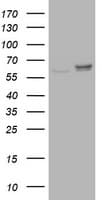 RPN2 / Ribophorin II Antibody (clone OTI1G9)