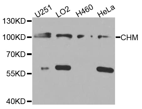 IHC-plus™ CHM / REP1 Antibody