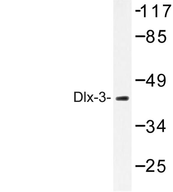 Polyclonal Rabbit anti-Human DLX3 Antibody (Asp107, IHC, WB)