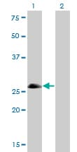 Monoclonal Mouse anti-Human ASCL1 / MASH1 Antibody (clone 7E11, WB)