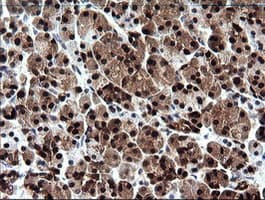CMPK / CMPK1 Antibody (clone OTI1H8)
