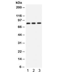 CLU / Clusterin Antibody