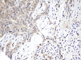 Monoclonal Mouse anti-Human ARL2BP / BART Antibody (clone OTI1F8, IHC, WB)