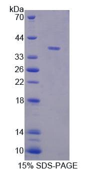 Human TECTB Protein (Recombinant His-T7)