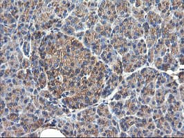 TUBAL3 Antibody (clone OTI4D8)