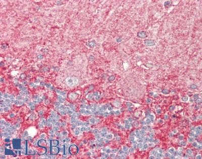 IHC-plus™ Polyclonal Rabbit anti-Human TRIM3 Antibody (aa1-50, IHC)