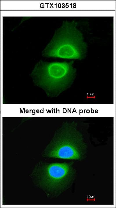 Polyclonal Rabbit anti-Human CYP4A11 Antibody (aa48-316, IHC, WB)