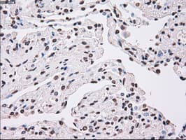 PLK1 / PLK-1 Antibody (clone OTI6C6)