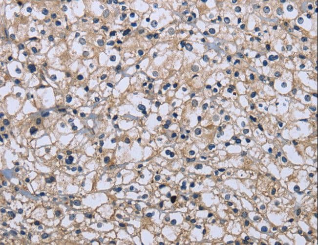 MAPRE3 / EB3 Antibody